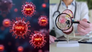 क्या HMPV किडनी को प्रभावित कर सकता है – HMPV linked with kidney disease