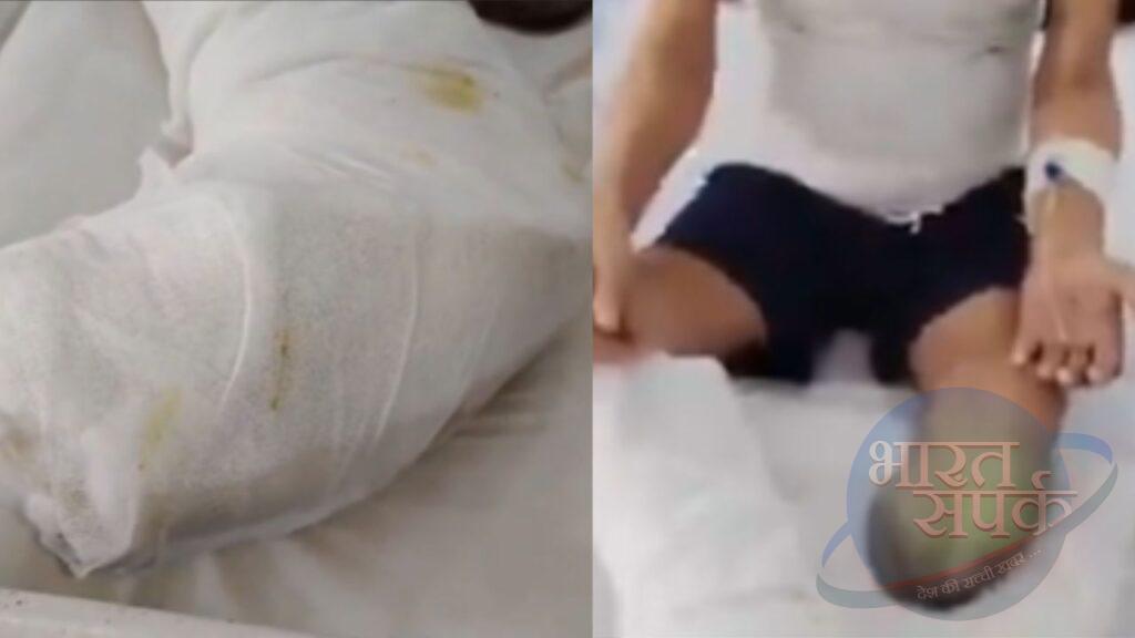 पटना के सरकारी अस्पताल में चूहों की मार, हड्डी का इलाज कराने आए मरीज की…