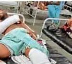 राशी स्टील प्लांट के ठेकेदार पर जानलेवा हमला, 10 हजार रुपए…- भारत संपर्क