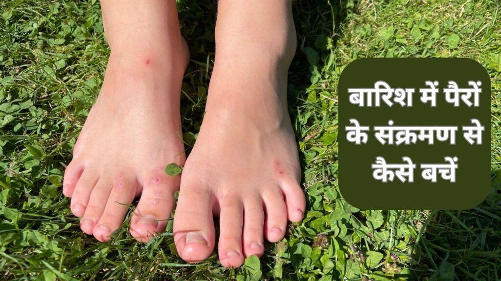 Monsoon Tips: बारिश में पैरों में न हो जाए संक्रमण, इन बातों का रखें ख्याल Monsoon Tips: बारिश में पैरों में न हो जाए संक्रमण, इन बातों का रखें ख्याल