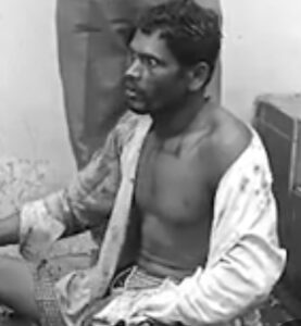 8 महीने पहले पिल्ले के काटने को नजरअंदाज करना पड़ा भारी,…- भारत संपर्क