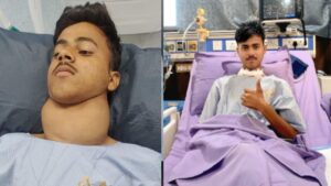 गले से छाती तक फैल गया था थायरॉयड, सिर्फ 30 परसेंट हार्ट कर रहा था पंप, डॉक… – भारत संपर्क