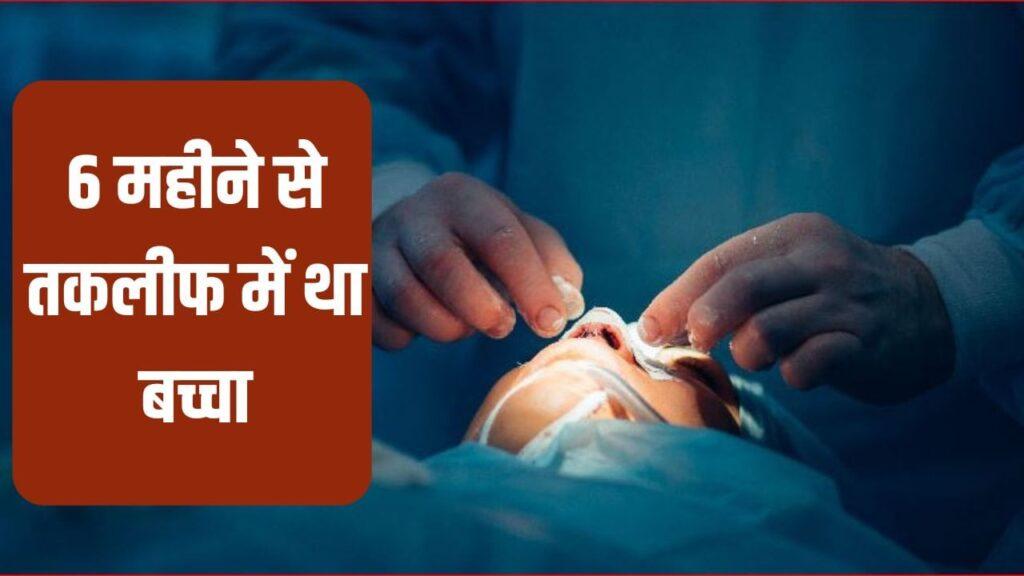 नाक के अंदर अचानक निकल आया दांत, सांस भी नहीं ले पा रहा था मासूम… AIIMS क… – भारत संपर्क