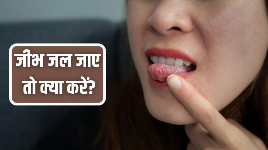 Home Remedies: गलती से चाय से जीभ जल जाए तो क्या करें? देसी घी से चीनी तक…ये…
