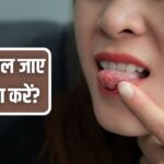 Home Remedies: गलती से चाय से जीभ जल जाए तो क्या करें? देसी घी से चीनी तक…ये…